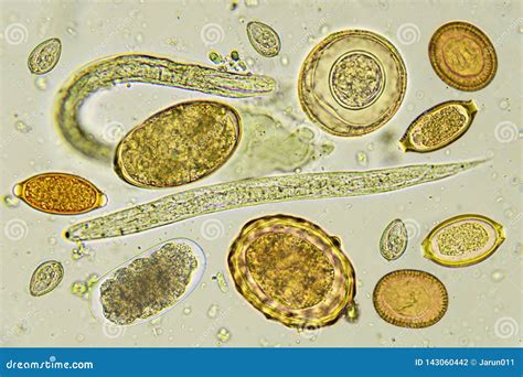 Isospora! Ein mikroskopischer Parasit der eine Vielzahl von Wirbeltieren befallen kann