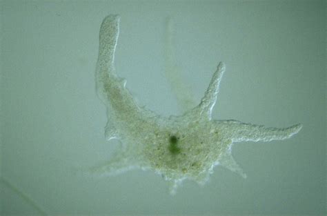  Mooreiella! Ein faszinierender Einblick in die Welt eines mikroskopischen Riesen unter den Amoebozoa